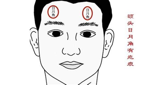 日月角隆起 面相